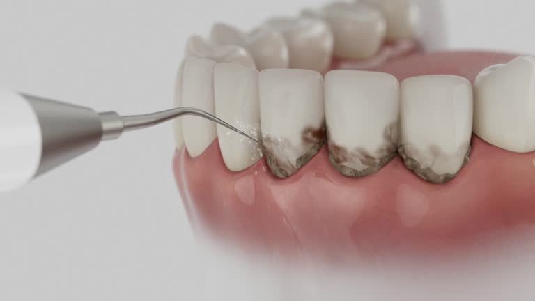 Reliable Emergency Dentist contractor in Colma, CA by Smile Center Dentistry
